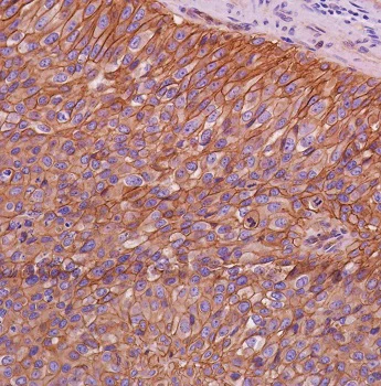 Immunohistochemistry (Formalin/PFA-fixed paraffin-embedded sections) - Anti-beta Catenin antibody [SP328] - BSA and Azide free (AB242424)