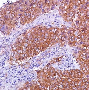 Immunohistochemistry (Formalin/PFA-fixed paraffin-embedded sections) - Anti-beta Catenin antibody [SP328] - BSA and Azide free (AB242424)