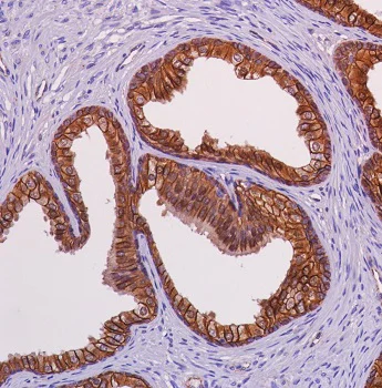 Immunohistochemistry (Formalin/PFA-fixed paraffin-embedded sections) - Anti-beta Catenin antibody [SP328] - BSA and Azide free (AB242424)