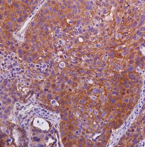 Immunohistochemistry (Formalin/PFA-fixed paraffin-embedded sections) - Anti-beta Catenin antibody [SP328] - BSA and Azide free (AB242424)