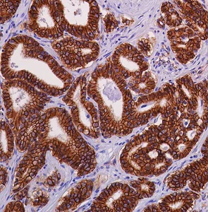 Immunohistochemistry (Formalin/PFA-fixed paraffin-embedded sections) - Anti-beta Catenin antibody [SP328] - BSA and Azide free (AB242424)