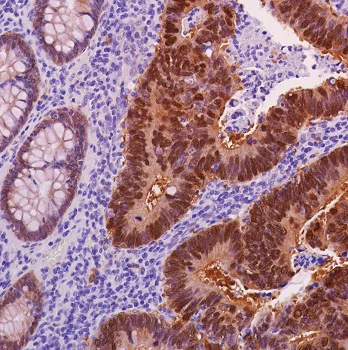 Immunohistochemistry (Formalin/PFA-fixed paraffin-embedded sections) - Anti-beta Catenin antibody [SP328] - BSA and Azide free (AB242424)