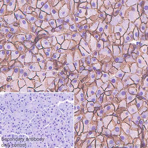 Immunohistochemistry (Formalin/PFA-fixed paraffin-embedded sections) - Anti-beta Catenin antibody [SP328] - BSA and Azide free (AB242424)