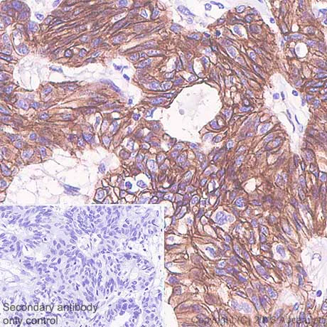 Immunohistochemistry (Formalin/PFA-fixed paraffin-embedded sections) - Anti-beta Catenin antibody [SP328] - BSA and Azide free (AB242424)
