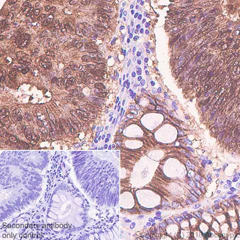 Immunohistochemistry (Formalin/PFA-fixed paraffin-embedded sections) - Anti-beta Catenin antibody [SP328] - BSA and Azide free (AB242424)