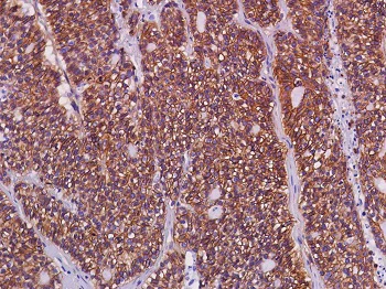 Immunohistochemistry (Formalin/PFA-fixed paraffin-embedded sections) - Anti-beta Catenin antibody [SP328] - BSA and Azide free (AB242424)