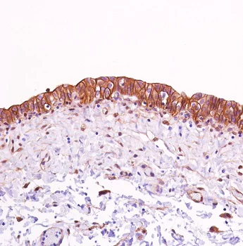 Immunohistochemistry (Formalin/PFA-fixed paraffin-embedded sections) - Anti-beta Catenin antibody [SP328] - BSA and Azide free (AB242424)