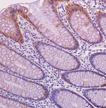 Immunohistochemistry (Formalin/PFA-fixed paraffin-embedded sections) - Anti-beta Catenin antibody [SP328] - BSA and Azide free (AB242424)