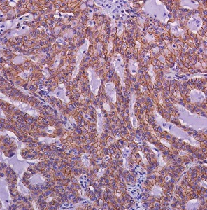 Immunohistochemistry (Formalin/PFA-fixed paraffin-embedded sections) - Anti-beta Catenin antibody [SP328] - BSA and Azide free (AB242424)