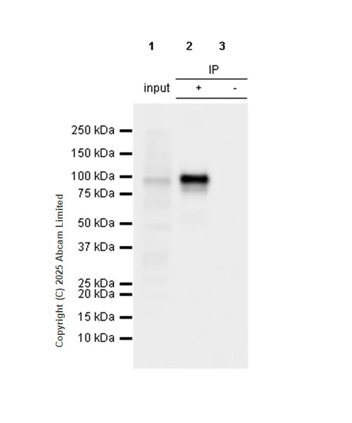 Immunoprecipitation - Anti-beta Catenin antibody [SP328] - BSA and Azide free (AB242424)