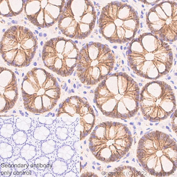 Immunohistochemistry (Formalin/PFA-fixed paraffin-embedded sections) - Anti-beta Catenin non-phospho S37/T41 antibody [EPR23969-131] (AB246504)