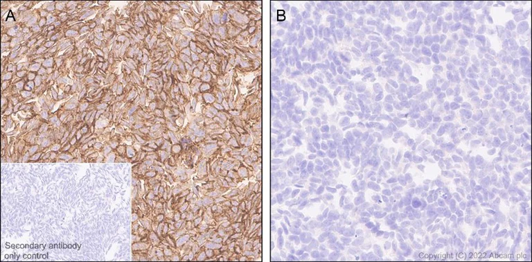 Immunohistochemistry (Formalin/PFA-fixed paraffin-embedded sections) - Anti-beta Catenin non-phospho S37/T41 antibody [EPR23969-131] (AB246504)