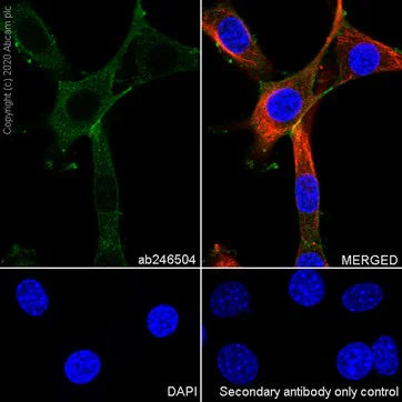 Immunocytochemistry/ Immunofluorescence - Anti-beta Catenin non-phospho S37/T41 antibody [EPR23969-131] - BSA and Azide free (AB278503)