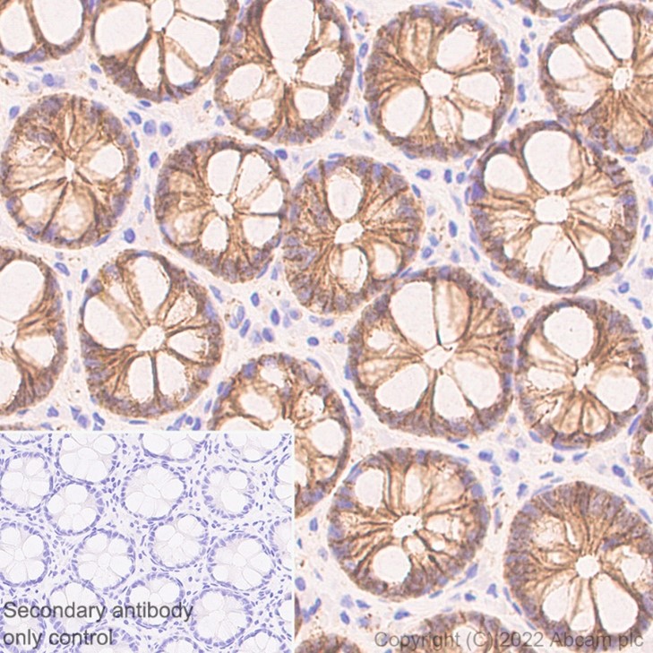 Immunohistochemistry (Formalin/PFA-fixed paraffin-embedded sections) - Anti-beta Catenin non-phospho S37/T41 antibody [EPR23969-131] - BSA and Azide free (ab278503), expandable thumbnail
