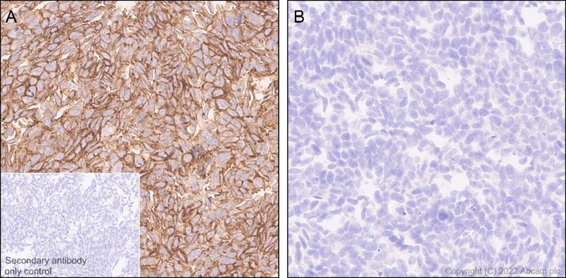 Immunohistochemistry (Formalin/PFA-fixed paraffin-embedded sections) - Anti-beta Catenin non-phospho S37/T41 antibody [EPR23969-131] - BSA and Azide free (ab278503), expandable thumbnail