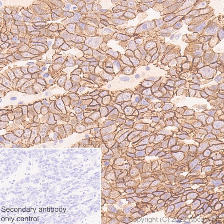 Immunohistochemistry (Formalin/PFA-fixed paraffin-embedded sections) - Anti-beta Catenin non-phospho S37/T41 antibody [EPR23969-131] - BSA and Azide free (ab278503), expandable thumbnail