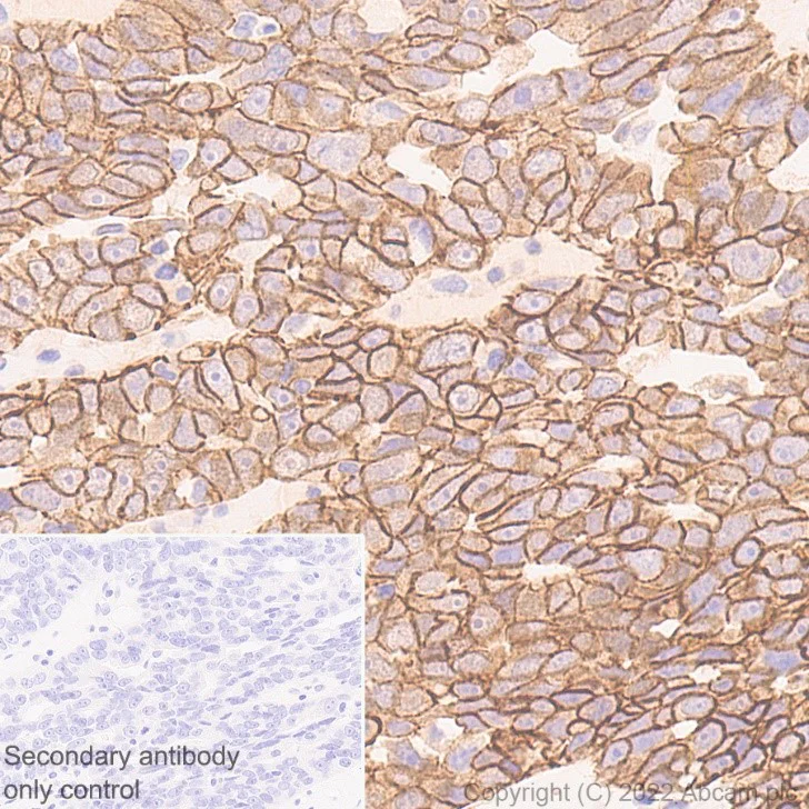 Immunohistochemistry (Formalin/PFA-fixed paraffin-embedded sections) - Anti-beta Catenin non-phospho S37/T41 antibody [EPR23969-131] - BSA and Azide free (AB278503)