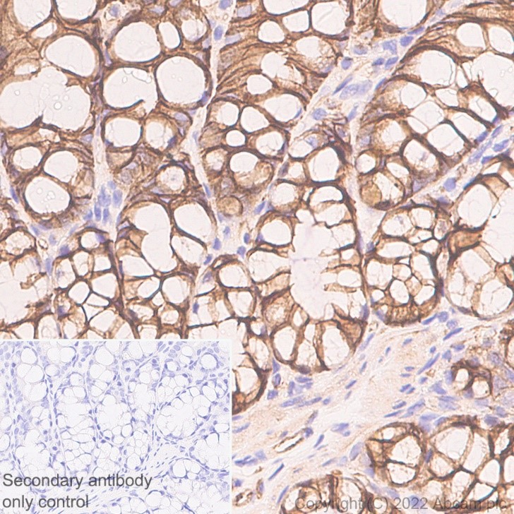 Immunohistochemistry (Formalin/PFA-fixed paraffin-embedded sections) - Anti-beta Catenin non-phospho S37/T41 antibody [EPR23969-131] - BSA and Azide free (ab278503), expandable thumbnail