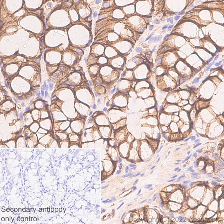 Immunohistochemistry (Formalin/PFA-fixed paraffin-embedded sections) - Anti-beta Catenin non-phospho S37/T41 antibody [EPR23969-131] - BSA and Azide free (AB278503)