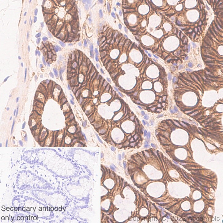 Immunohistochemistry (Formalin/PFA-fixed paraffin-embedded sections) - Anti-beta Catenin non-phospho S37/T41 antibody [EPR23969-131] - BSA and Azide free (ab278503), expandable thumbnail