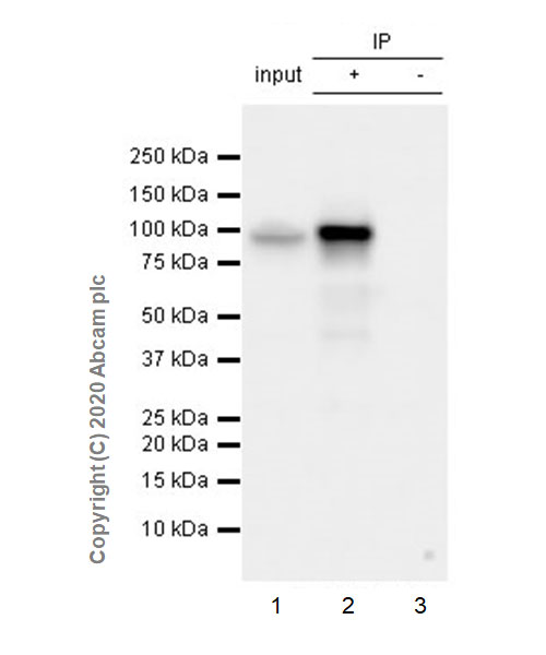 Immunoprecipitation - Anti-beta Catenin non-phospho S37/T41 antibody [EPR23969-131] - BSA and Azide free (AB278503), expandable thumbnail