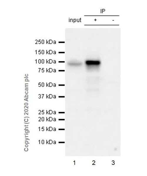 Immunoprecipitation - Anti-beta Catenin non-phospho S37/T41 antibody [EPR23969-131] - BSA and Azide free (AB278503)