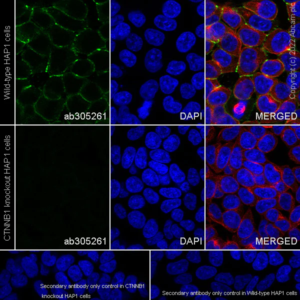 Immunocytochemistry/ Immunofluorescence - Anti-beta Catenin non-phospho(active) S45 antibody [EPR26155-110-1] (AB305261)