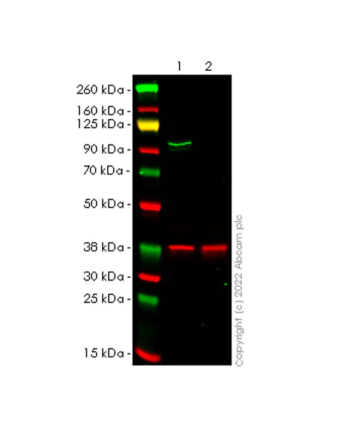 Western blot - Anti-beta Catenin non-phospho(active) S45 antibody [EPR26155-110-1] (AB305261)