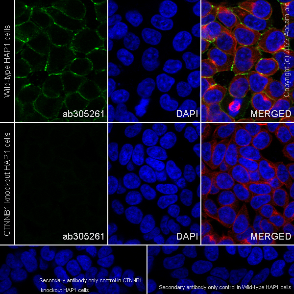 Immunocytochemistry/ Immunofluorescence - Anti-beta Catenin non-phospho(active) S45 antibody [EPR26155-110-1] - BSA and Azide free (AB305262), expandable thumbnail