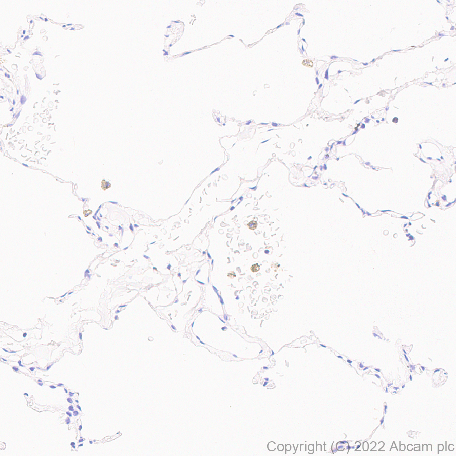Immunohistochemistry (Formalin/PFA-fixed paraffin-embedded sections) - Anti-beta Catenin non-phospho(active) S45 antibody [EPR26155-110-1] - BSA and Azide free (AB305262), expandable thumbnail