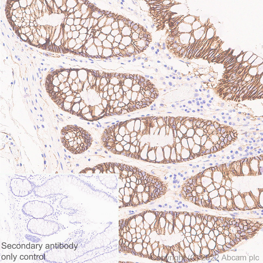 Immunohistochemistry (Formalin/PFA-fixed paraffin-embedded sections) - Anti-beta Catenin non-phospho(active) S45 antibody [EPR26155-110-1] - BSA and Azide free (AB305262), expandable thumbnail