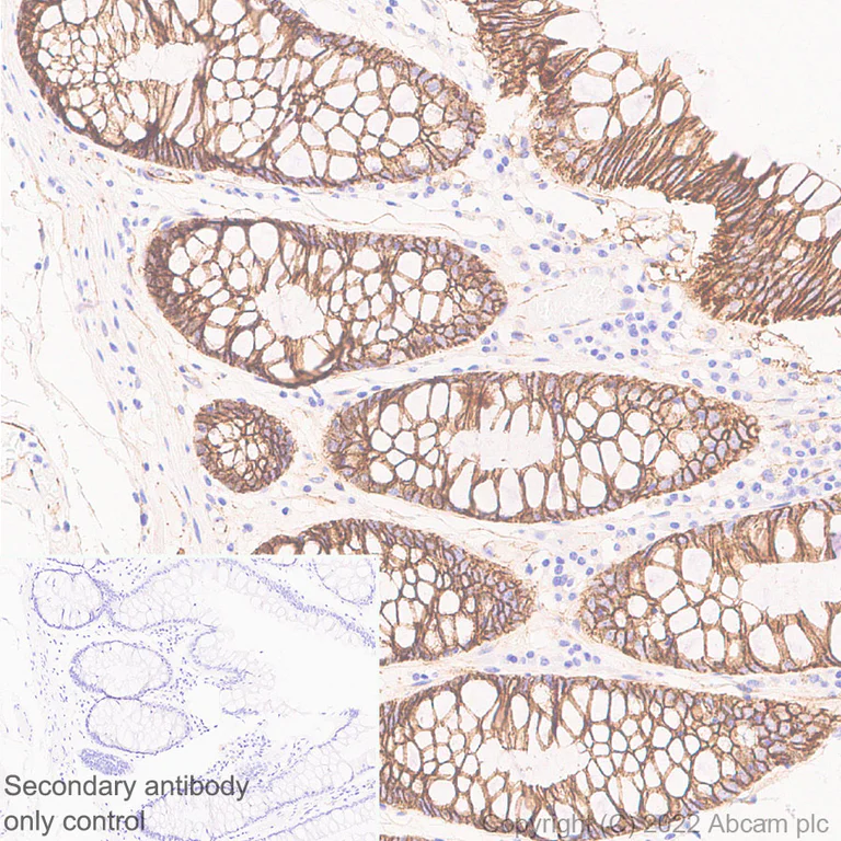 Immunohistochemistry (Formalin/PFA-fixed paraffin-embedded sections) - Anti-beta Catenin non-phospho(active) S45 antibody [EPR26155-110-1] - BSA and Azide free (AB305262)
