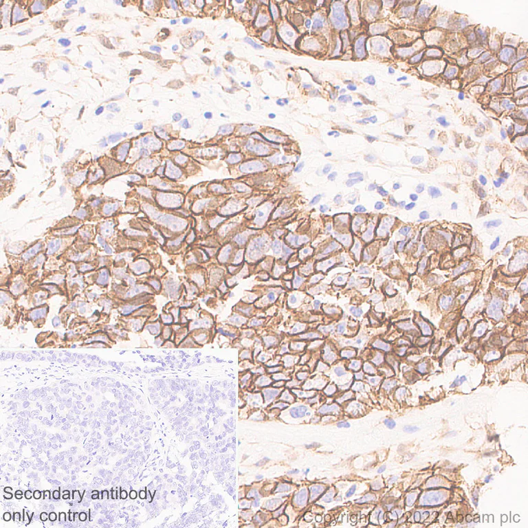 Immunohistochemistry (Formalin/PFA-fixed paraffin-embedded sections) - Anti-beta Catenin non-phospho(active) S45 antibody [EPR26155-110-1] - BSA and Azide free (AB305262)