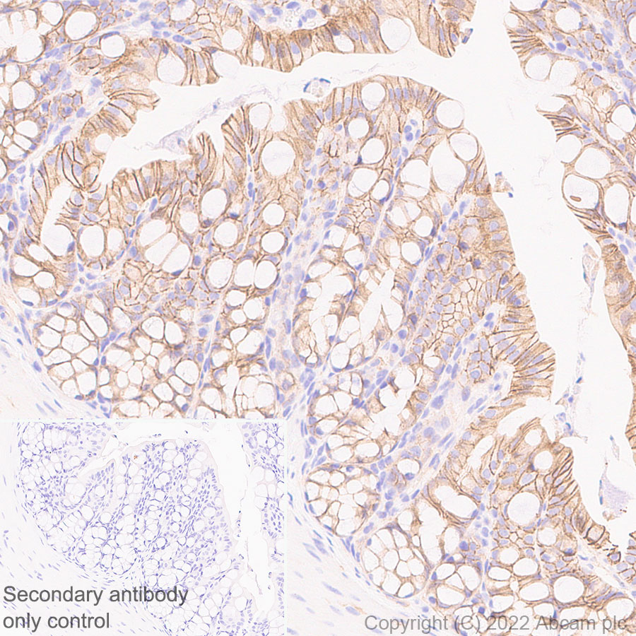Immunohistochemistry (Formalin/PFA-fixed paraffin-embedded sections) - Anti-beta Catenin non-phospho(active) S45 antibody [EPR26155-110-1] - BSA and Azide free (ab305262), expandable thumbnail