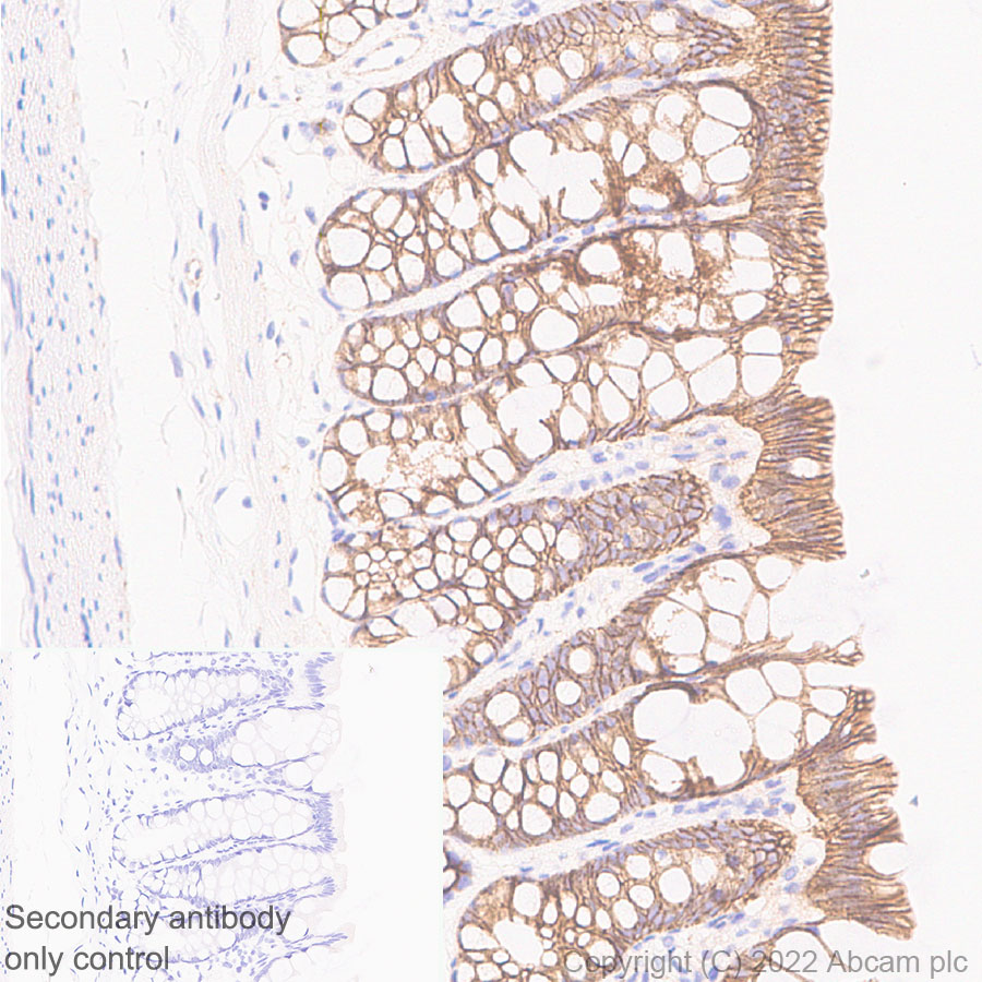 Immunohistochemistry (Formalin/PFA-fixed paraffin-embedded sections) - Anti-beta Catenin non-phospho(active) S45 antibody [EPR26155-110-1] - BSA and Azide free (ab305262), expandable thumbnail