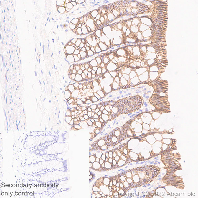 Immunohistochemistry (Formalin/PFA-fixed paraffin-embedded sections) - Anti-beta Catenin non-phospho(active) S45 antibody [EPR26155-110-1] - BSA and Azide free (AB305262)
