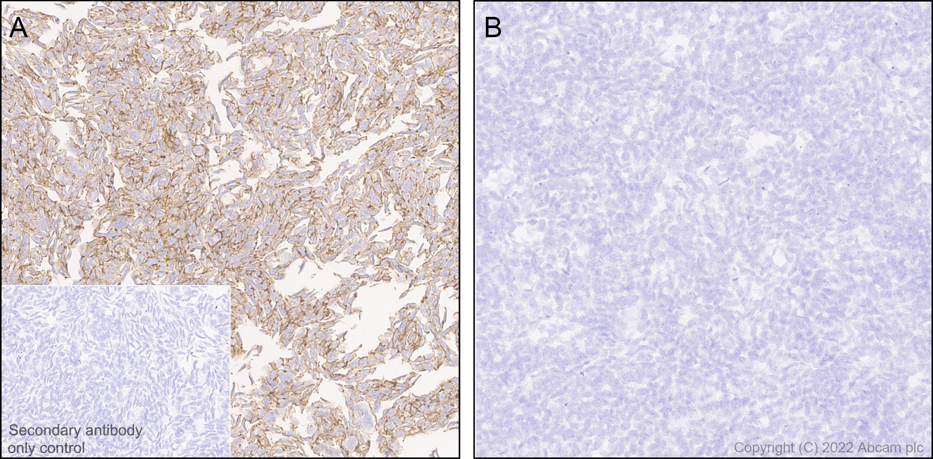 Immunohistochemistry (Formalin/PFA-fixed paraffin-embedded sections) - Anti-beta Catenin non-phospho(active) S45 antibody [EPR26155-110-1] - BSA and Azide free (AB305262), expandable thumbnail