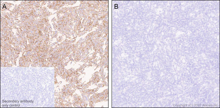 Immunohistochemistry (Formalin/PFA-fixed paraffin-embedded sections) - Anti-beta Catenin non-phospho(active) S45 antibody [EPR26155-110-1] - BSA and Azide free (AB305262)