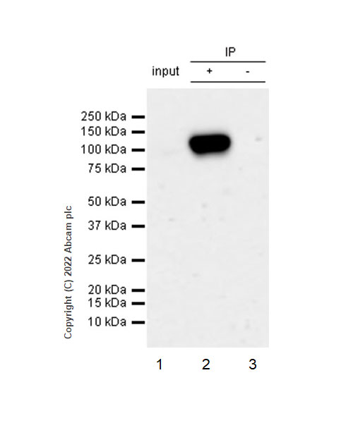 Immunoprecipitation - Anti-beta Catenin non-phospho(active) S45 antibody [EPR26155-110-1] - BSA and Azide free (ab305262), expandable thumbnail