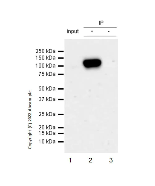 Immunoprecipitation - Anti-beta Catenin non-phospho(active) S45 antibody [EPR26155-110-1] - BSA and Azide free (AB305262)
