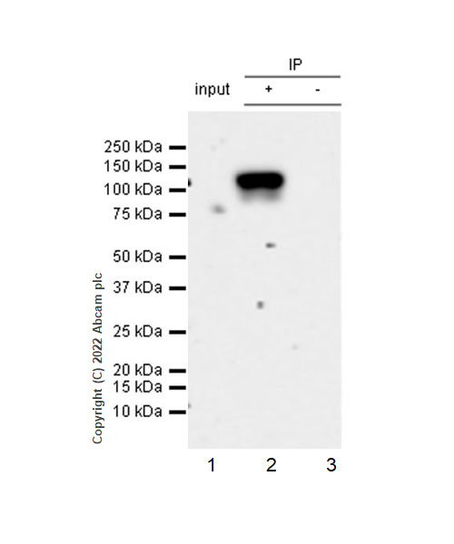 Immunoprecipitation - Anti-beta Catenin non-phospho(active) S45 antibody [EPR26155-110-1] - BSA and Azide free (ab305262), expandable thumbnail