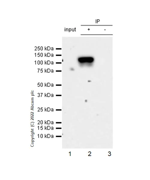 Immunoprecipitation - Anti-beta Catenin non-phospho(active) S45 antibody [EPR26155-110-1] - BSA and Azide free (AB305262)