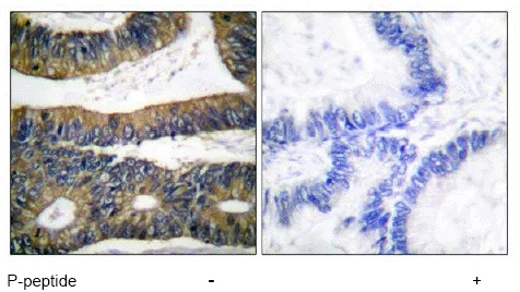 Immunohistochemistry (Formalin/PFA-fixed paraffin-embedded sections) - Anti-beta Catenin (phospho S33) antibody (AB53050)