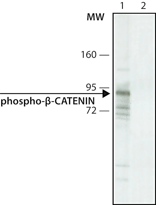 Western blot - Anti-beta Catenin (phospho S33 + S37) antibody [BC-22] (AB11350)