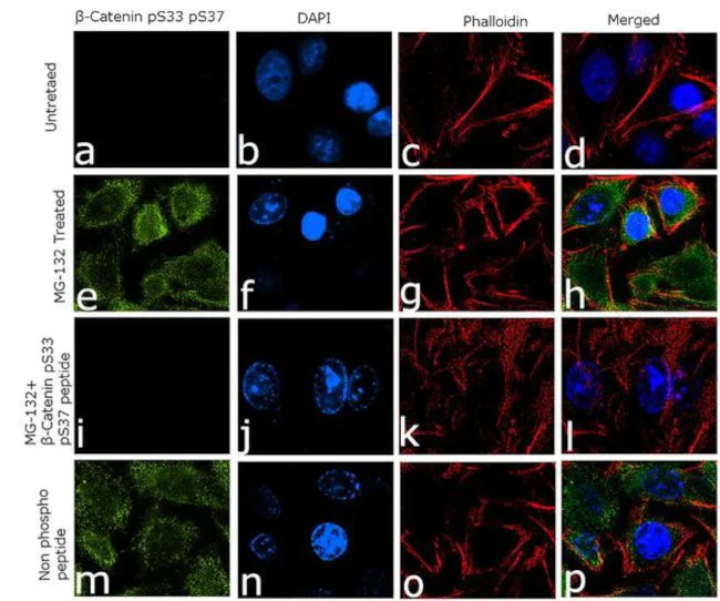 Immunocytochemistry/ Immunofluorescence - Anti-beta Catenin (phospho S33 + S37) Antibody [RP23040186] (AB313475)