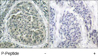 Immunohistochemistry (Formalin/PFA-fixed paraffin-embedded sections) - Anti-beta Catenin (phospho S37) antibody (AB47335)