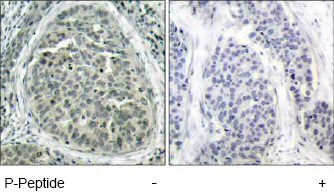 Immunohistochemistry (Formalin/PFA-fixed paraffin-embedded sections) - Anti-beta Catenin (phospho S37) antibody (AB47335)