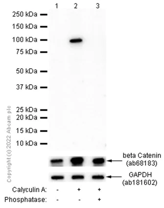 Western blot - Anti-beta Catenin (phospho S37) antibody [EP742(2)Y] (AB75777)