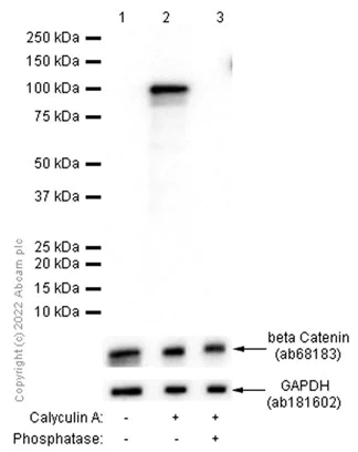 Western blot - Anti-beta Catenin (phospho S37) antibody [EP742(2)Y] (AB75777)
