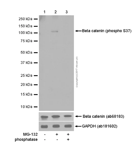 Western blot - Anti-beta Catenin (phospho S37) antibody [EP742(2)Y] - BSA and Azide free (AB247399)
